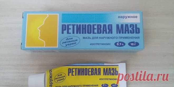 Ретиноевая мазь - от чего помогает, состав, инструкция по применению, аналоги и цена Ретиноевая мазь – эффективное средство, которое продлевает молодость, устраняет дефекты кожи и дерматологические заболевания. Каждая женщина должна иметь ее в своей косметичке.