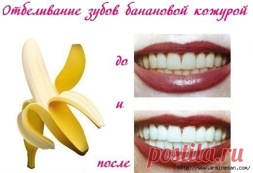 Отбеливание зубов банановой кожурой.