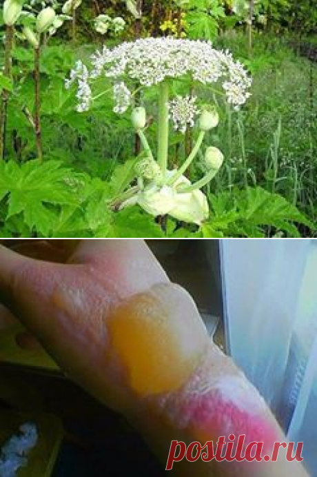 Внимание!!! Очень опасное растение &quot;Борщевик&quot;, вызывает сильнейшие ожоги, а попав в глаза, может вызвать слепоту!!! Предупредите своих детей! Просьба распространить!