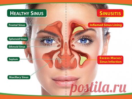 Сколько стоит восстановить все зубы во рту