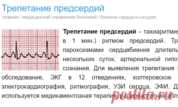 Трепетание предсердий - причины, симптомы, диагностика и лечение