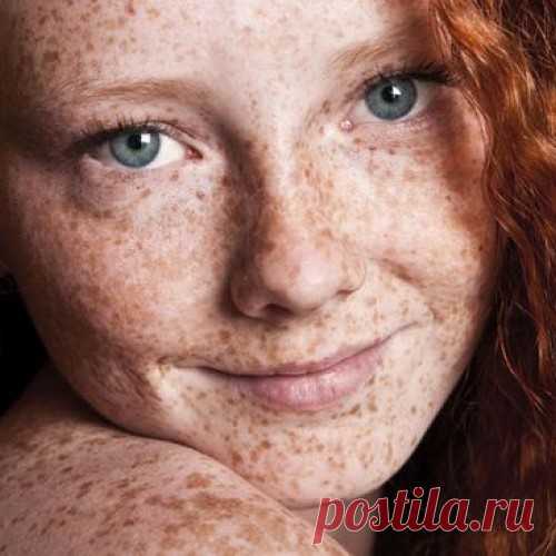 Эскулап: Лекарственные растения в косметологии: Веснушки