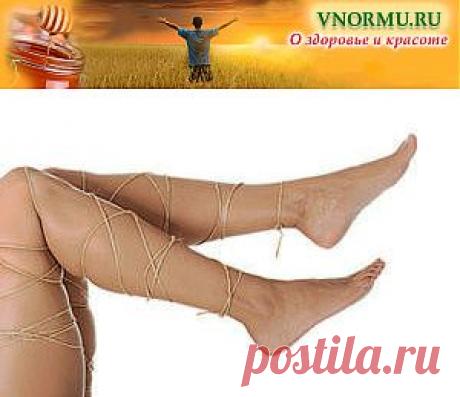 Грамотное лечение варикоза в домашних условиях