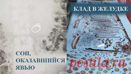7 очень странных обращений к врачам с неординарными проблемами и случаями