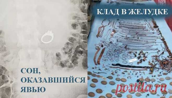 7 очень странных обращений к врачам с неординарными проблемами и случаями