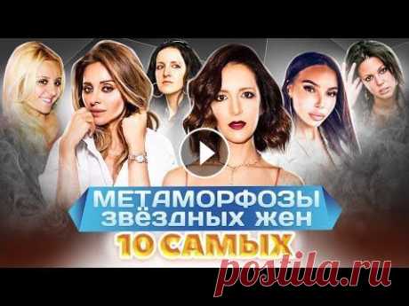 Жены звезд до и после пластики | Самойлова, Ревва, Галустян, Шнурова, Брухунова Метаморфозы звёздных жён. 10 самых. Сравните до и после. Как меняет женщину звёздный статус мужа? Анжелика Ревва, Виктория Галустян, Матильда Шнурова,...