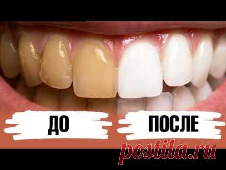 Как отбелить зубы дома? 2 ингредиента и зубная паста готова!🔥