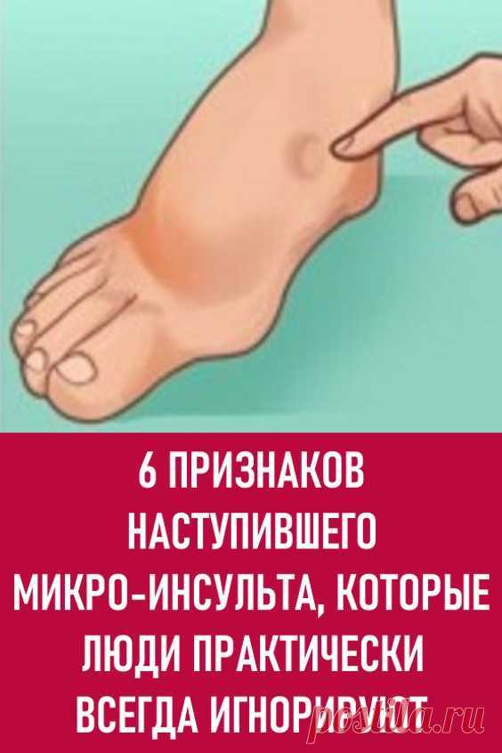 6 признаков наступившего микро-инсульта, которые люди почти всегда игнорируют. Каждую минуту во время инсульта мозг человека теряет почти два миллиона клеток, а каждый час без врачебной помощи старит наш мозг на три с половиной года.