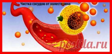 Как почистить сосуды головного мозга от холестерина - perchinka63.ru