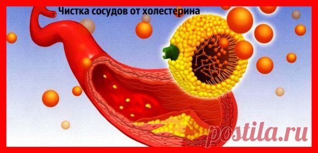 Как почистить сосуды головного мозга от холестерина - perchinka63.ru