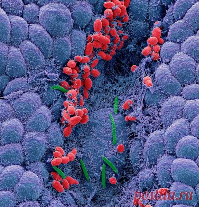 Желудок должен быть здоровым, без Helicobacter pylori. Как я решала проблему защиты организма, мой опыт
Дорогие мои читатели! Я уже много писала о том, что у меня...
Читай пост далее на сайте. Жми ⏫ссылку выше