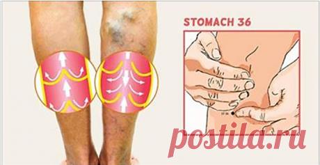 Домашние средства от варикозного расширения вен! Почему бы не попробовать? Варикозные вены — это вены, аномально увеличенные и близкие к поверхности кожи. Они являются результатом неисправности клапанов