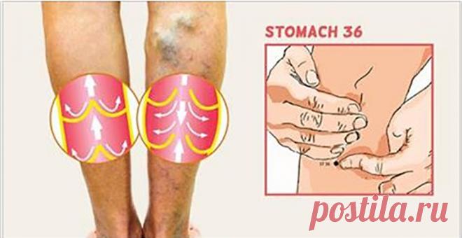 Домашние средства от варикозного расширения вен! Почему бы не попробовать? Варикозные вены — это вены, аномально увеличенные и близкие к поверхности кожи. Они являются результатом неисправности клапанов
