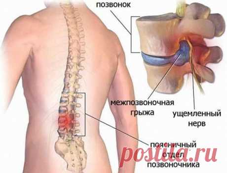 Полезные упражнения!

Ляг на спину, расслабься. Начинай поочередно медленно сгибать ноги в коленях.

Теперь выпрямляй ноги и поднимай их. Только делай всё спокойно, не спеши.

Согни ноги в коленях и поочередно ставь одну ногу на колено другой.

Разворачивай ноги вправо и влево, при этом спина должна быть неподвижной.

Упражнения рекомендуют делать не только людям, которые страдают от межпозвоночной грыжи, но и для профилактики данного заболевания. Особенно если твоя деятел...