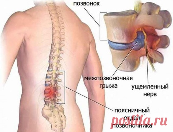 Полезные упражнения!

Ляг на спину, расслабься. Начинай поочередно медленно сгибать ноги в коленях.

Теперь выпрямляй ноги и поднимай их. Только делай всё спокойно, не спеши.

Согни ноги в коленях и поочередно ставь одну ногу на колено другой.

Разворачивай ноги вправо и влево, при этом спина должна быть неподвижной.

Упражнения рекомендуют делать не только людям, которые страдают от межпозвоночной грыжи, но и для профилактики данного заболевания. Особенно если твоя деятел...