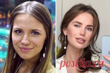 11 российских красавиц до и после пластики | Максим Котов | Дзен