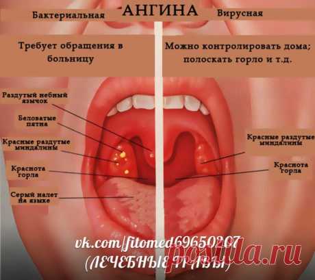 ЛЕЧЕБНЫЕ ТРАВЫ- Лечение народной медициной | ЗОЖ