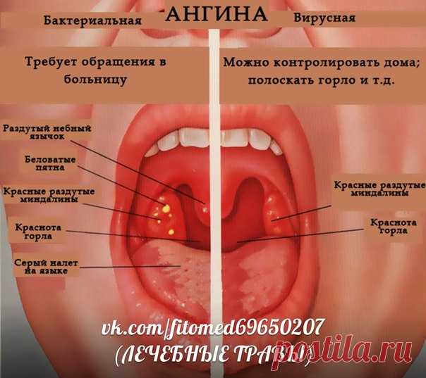 ЛЕЧЕБНЫЕ ТРАВЫ- Лечение народной медициной | ЗОЖ