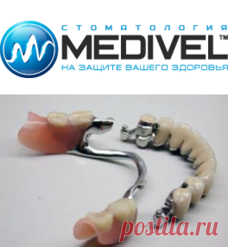 Съемное протезирование зубных имплантов недорого в Химках | MEDIVEL