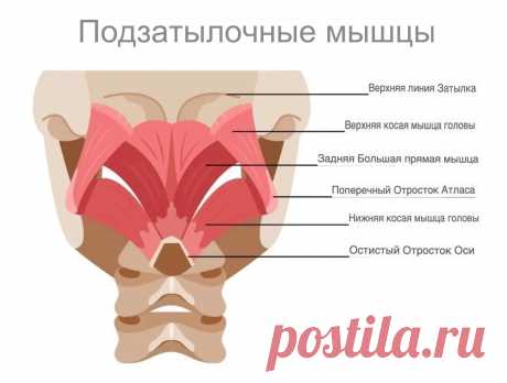 Боль в затылке. Триггерные точки
