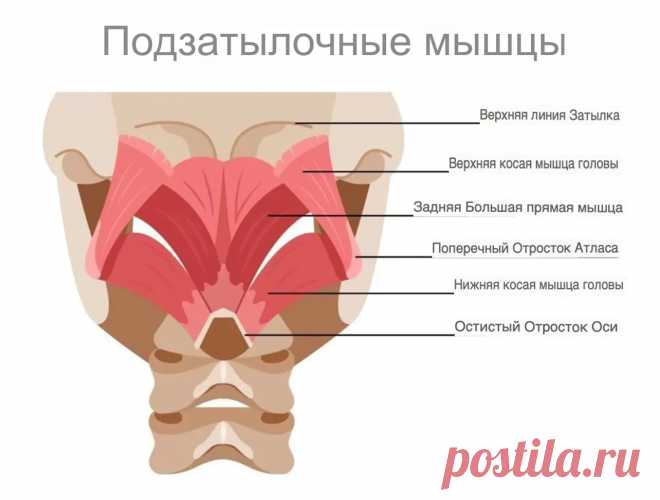 Боль в затылке. Триггерные точки