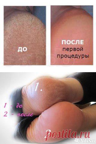 (63) Одноклассники