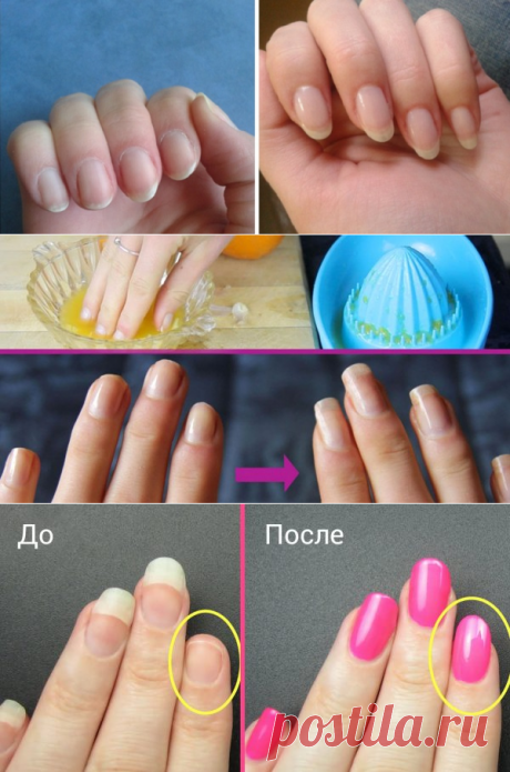 Как быстро отрастить ногти, которые никогда не сломаются: поможет простое средство из 4 компонентов!