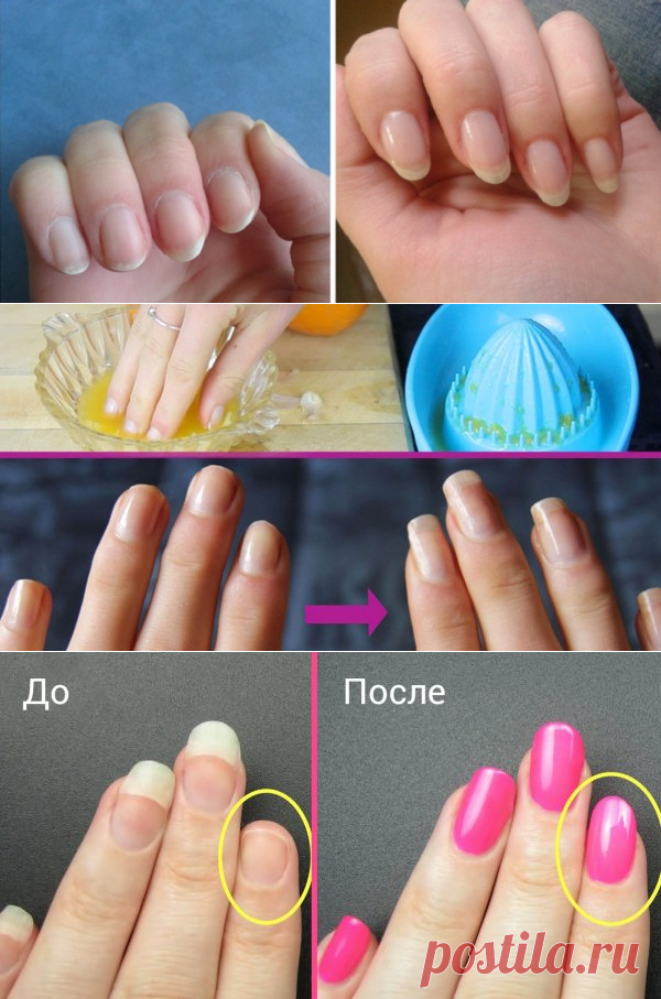 Как быстро отрастить ногти, которые никогда не сломаются: поможет простое средство из 4 компонентов!