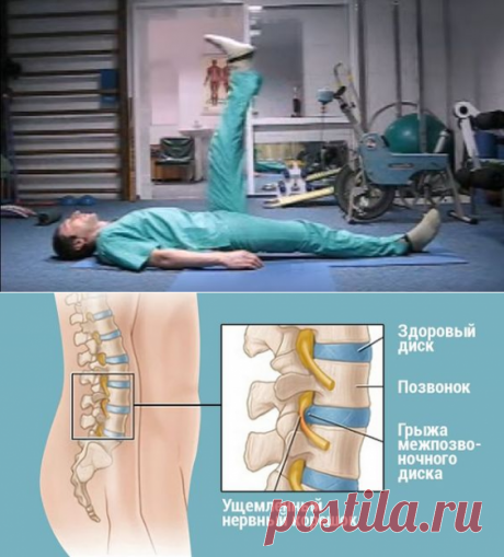 Хирург отговорил дядю от операции, посоветовав делать ЭТИ упражнения… Спустя полгода результат!