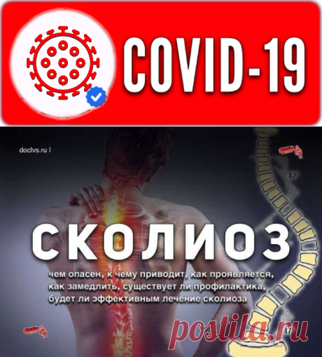 Сколиоз: причины, симптомы, диагностика, лечение, рекомендации