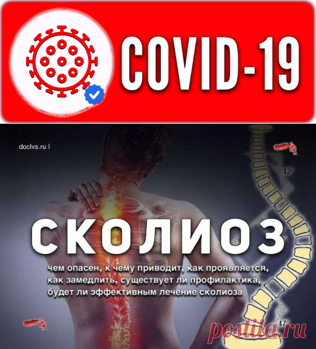 Сколиоз: причины, симптомы, диагностика, лечение, рекомендации