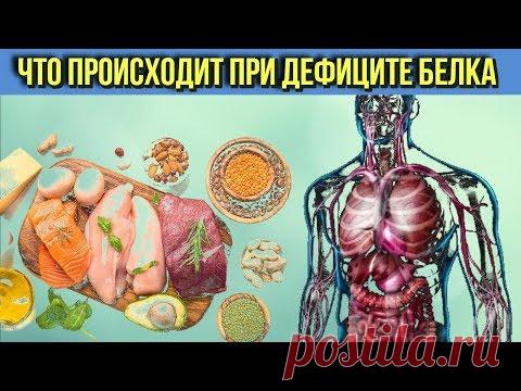 Вот Что может произойти с Организмом Человека при дефиците Белка - YouTube