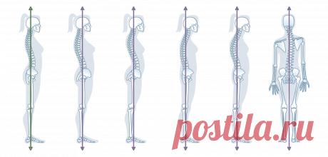 Коррекция осанки 2.0 - Видеокурс Ревитоники