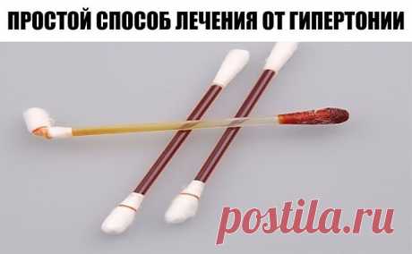 Гипертоники хорошо знают, что ощущения от повышенного давления очень неприятны: сначала - периодические головные боли, сердцебиения, потом — онемение пальцев рук и ног, приливы крови к голове.

Оно производится в два этапа:

Перерыв — десять дней.

Лечение этим способом производится так. Ватку на спичке обмакнуть в йод и довести кольцо:

1-й день — вокруг запястья левой руки;

2-й — вокруг щиколотки правой ноги;

3-й — вокруг запястья правой руки;

4-й — вокруг щиколотки л...
