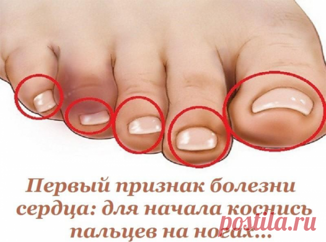 Первый признак болезни сердца: для начала коснись пальцев на ногах...
