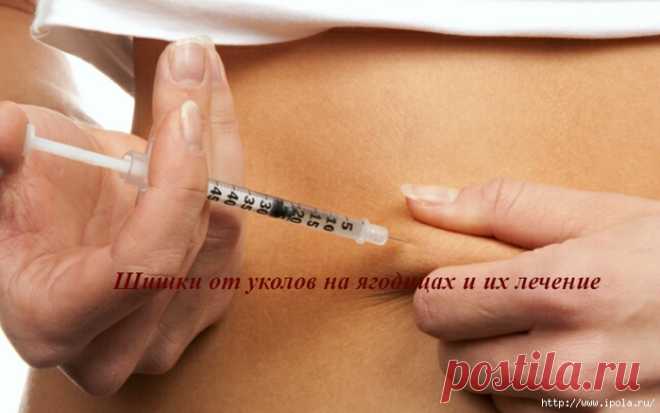 Шишки от уколов на ягодицах и их лечение