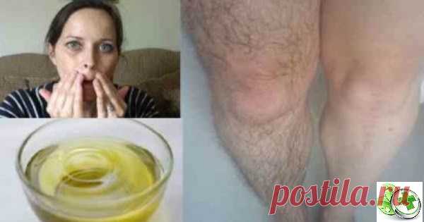 Всего 5 минут массажа с этим маслом и вы навсегда избавитесь от нежелательных волос!     Нежелательные волосы на видимых участках тела, таких как руки, ноги, лицо и спина, являются одной из основных проблем для многих женщин ...