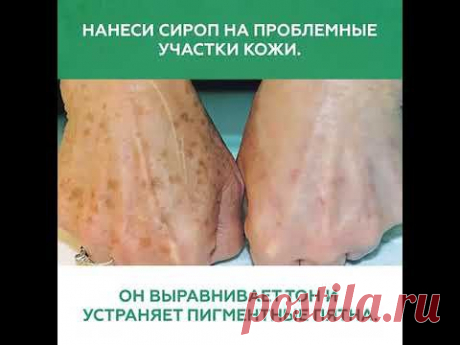 Красота из аптеки за копейки