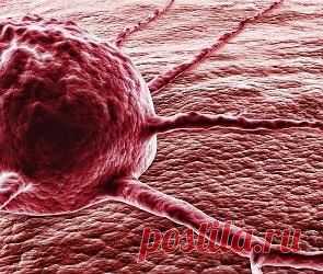 Рак последней стадии излечим