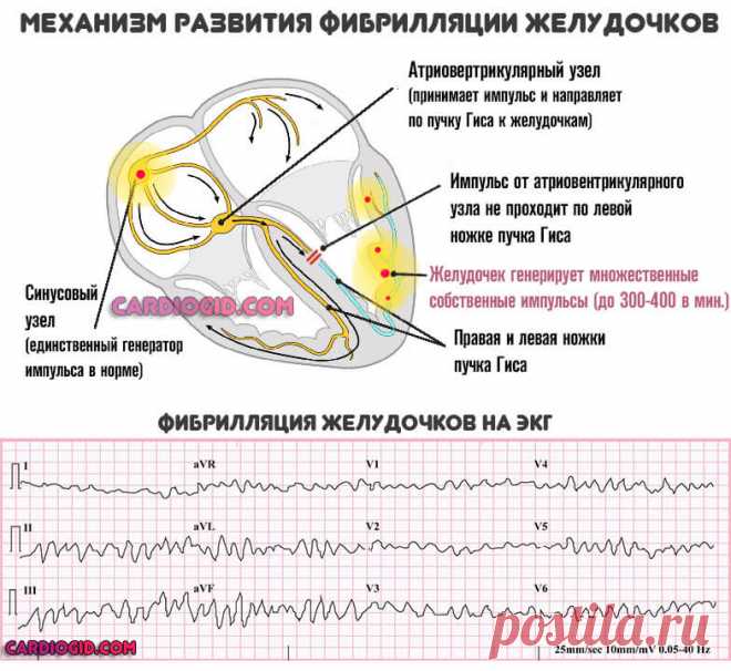 Антиаритмические препараты: список таблеток и лекарств для нормализации ЧСС