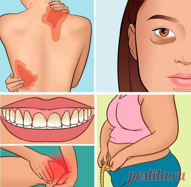 13 тревожных признаков того что вы едите слишком много сахара Интересные факты обо всём на свете, которых вы, возможно, не знали.