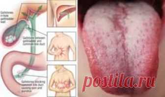 10 Warning Symptoms To Remind You It's Time to Flush Toxin Out of Your Body!Toxins are everywhere just waiting to overload our bodies and leave us hanging in