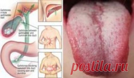 10 Warning Symptoms To Remind You It's Time to Flush Toxin Out of Your Body!Toxins are everywhere just waiting to overload our bodies and leave us hanging in