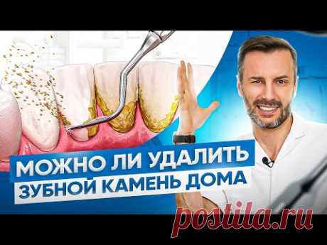 Средства для удаления зубного камня в домашних условиях. Опасно ли это?