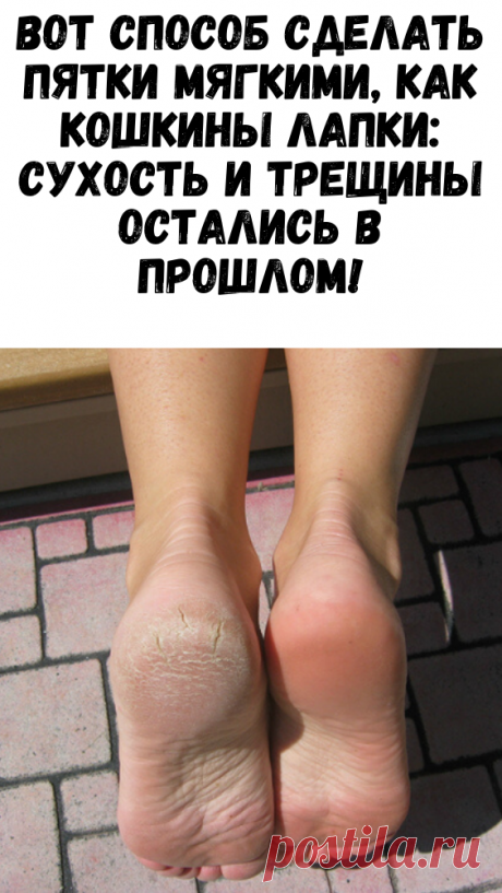 Вот способ сделать пятки мягкими, как кошкины лапки: сухость и трещины остались в прошлом! - Советы и Рецепты