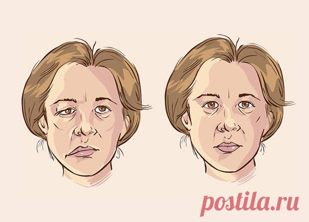 (99+) Как лечить неврит народными средствами... - Познавательный сайт ,,1000 мелочей