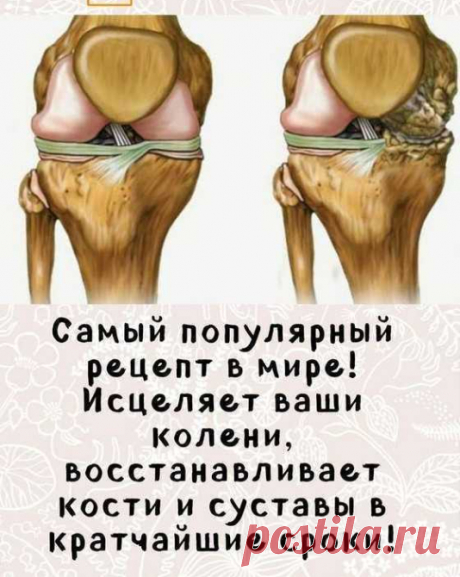 Самый популярный рецепт в мире! Исцеляет ваши колени, восстанавливает. Болят колени и суставы? Не можете нормально ходить и каждый шаг доставляет только дискомфорт? Есть простое средство, которое пользуется огромной популярностью в решении этой проблемы. Вы будете удивлены эффекту от его использования!