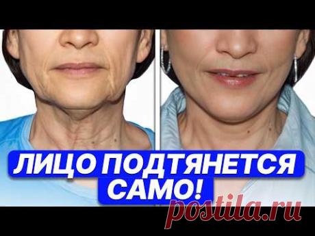 Косметологи НЕ ХОТЯТ, чтобы вы знали! СКРЫТЫЕ ПРИЧИНЫ птоза, как убрать обвисающее лицо?