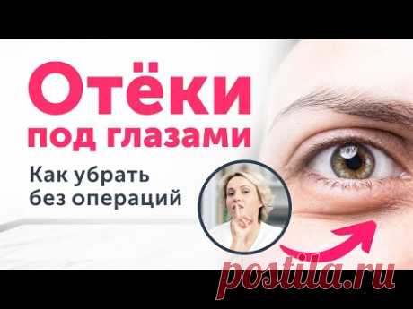 СКРЫТЫЕ причины МЕШКОВ под глазами. Как убрать без пластики?