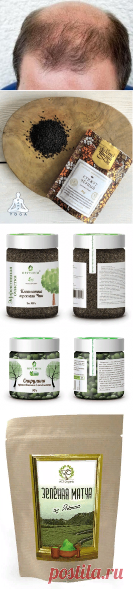 Диета при выпадении волос — как бороться с облысением?